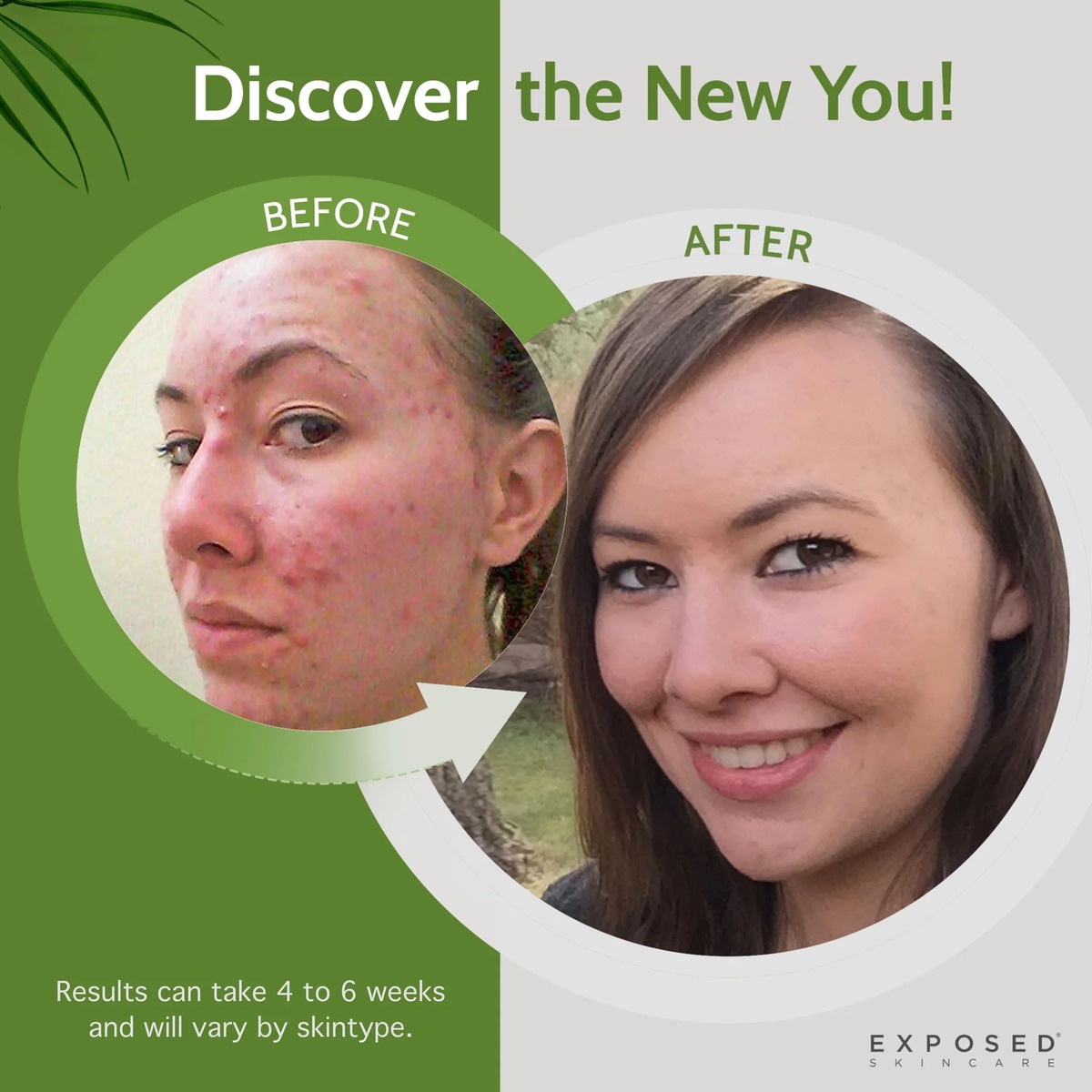 exposed skin care product image